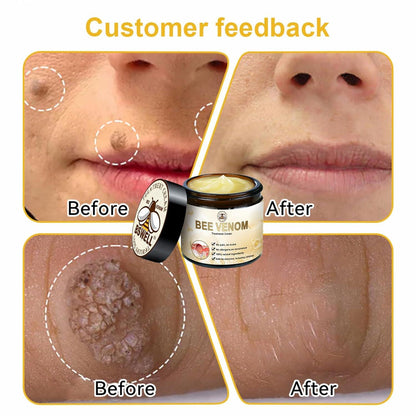 Bee Venom Repair Cream – Advanced Skin Repair for Face & Body