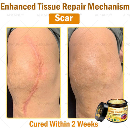 Bee Venom Repair Cream – Advanced Skin Repair for Face & Body