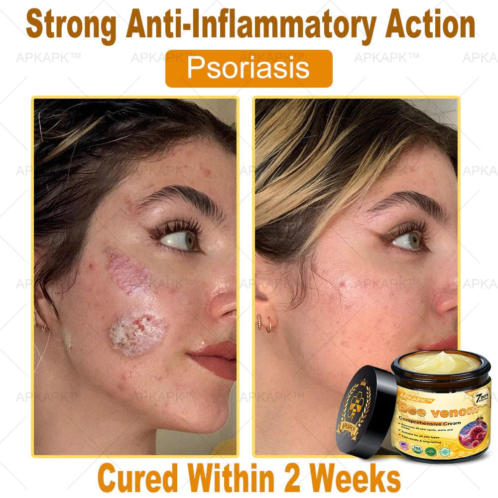 Bee Venom Repair Cream – Advanced Skin Repair for Face & Body