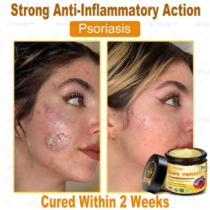 Bee Venom Repair Cream – Advanced Skin Repair for Face & Body